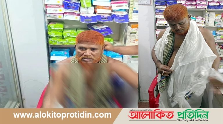 হামলাকারীরা ছিড়ে ফেলেছে কুয়াকাটা মেয়রের পরিধেয় পোশাক