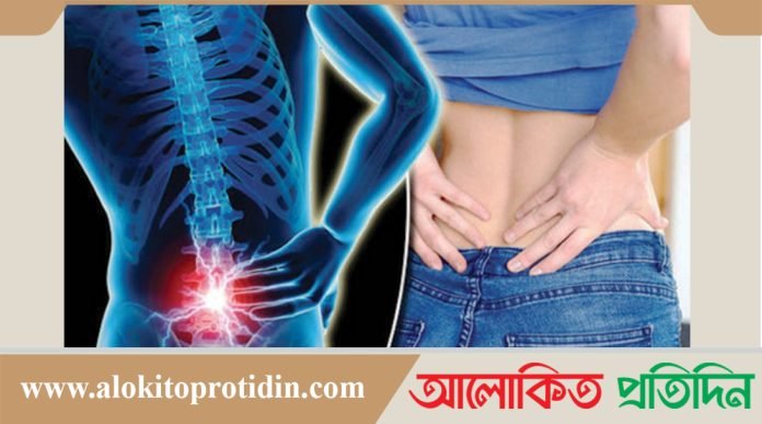 ঘরোয়া উপায়ে যেভাবে কোমর ব্যথা দূর করবেন