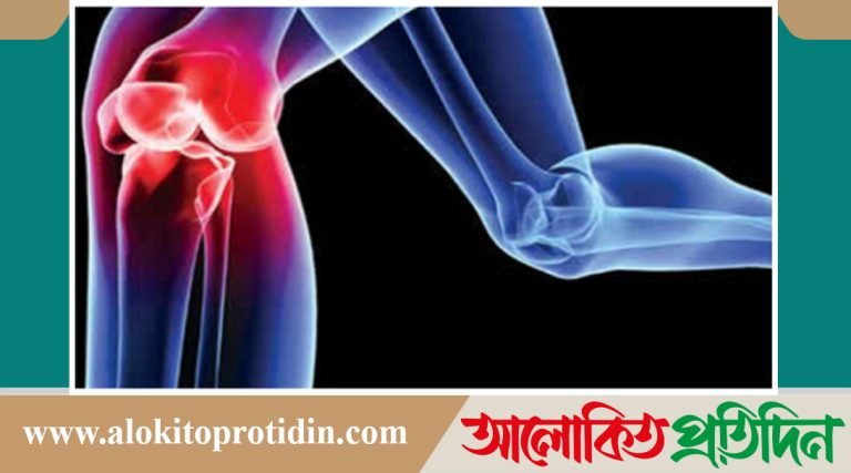 শীতে হাড় ভাঙার ঝুঁকি বাড়ে কেন, করণীয় কী!